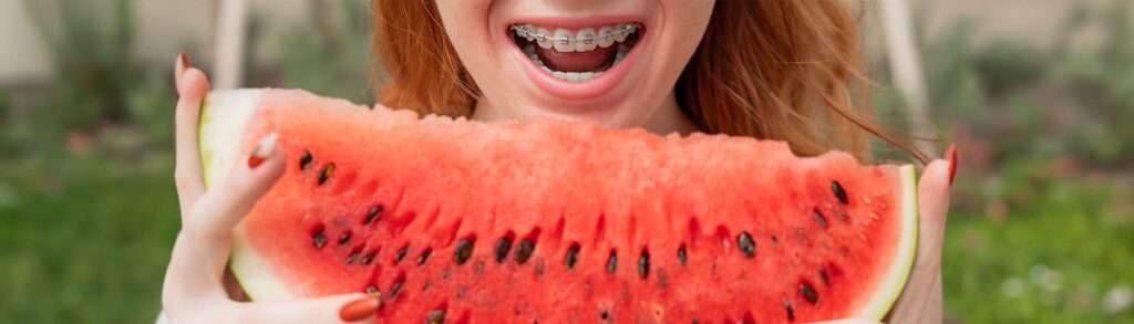 Czy nosząc klamerki na zębach, trzeba stosować odpowiednią dietę?