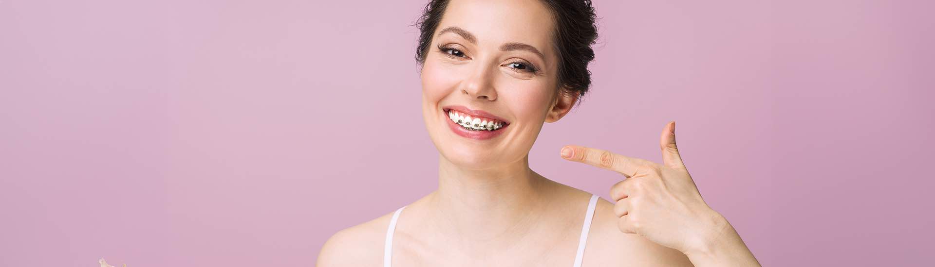 Czy warto prostować zęby? Aparat ortodontyczny – plusy i minusy