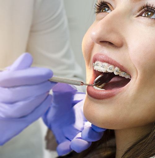 Uśmiechnięta kobieta nosząca aparat ortodontyczny podczas przeglądu 1